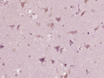 Phospho-c-Kit (Tyr721) Rabbit Polyclonal Antibody