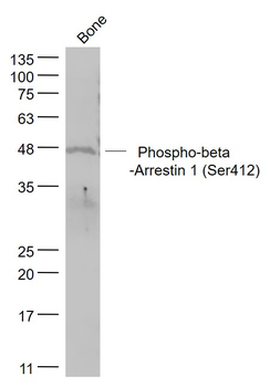 Phospho-beta-Arrestin 1 (Ser412) Rabbit Polyclonal Antibody