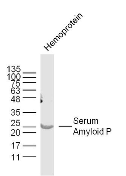 APCS Rabbit Polyclonal Antibody