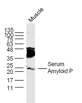 APCS Rabbit Polyclonal Antibody