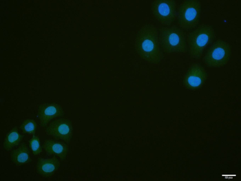 Phospho-eIF4EBP1 (Thr37 + Thr46) Rabbit Polyclonal Antibody