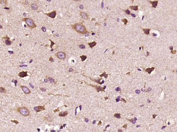 Phospho-ALOX5 (Ser271) Rabbit Polyclonal Antibody