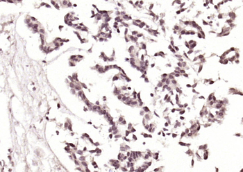 Phospho-ALOX5 (Ser663) Rabbit Polyclonal Antibody