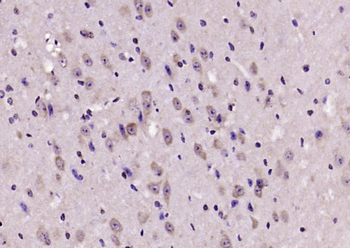 Phospho-ALOX5 (Ser663) Rabbit Polyclonal Antibody
