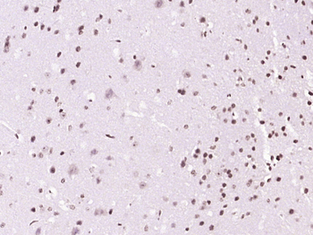 Phospho-BTK (Tyr223) Rabbit Polyclonal Antibody