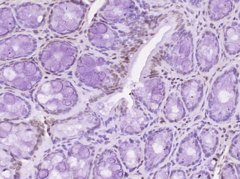 Phospho-BTK (Tyr223) Rabbit Polyclonal Antibody