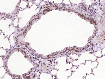 Phospho-BTK (Tyr223) Rabbit Polyclonal Antibody