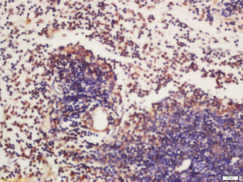 Phospho-BTK (Tyr223) Rabbit Polyclonal Antibody