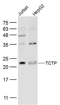 TCTP Rabbit Polyclonal Antibody