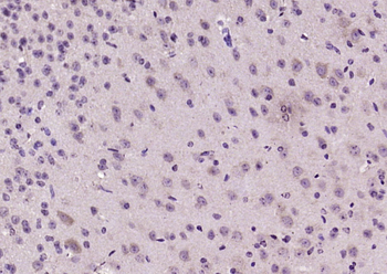 Phospho-TCTP (Ser46) Rabbit Polyclonal Antibody