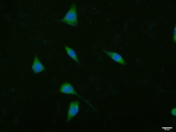ACACA Rabbit Polyclonal Antibody