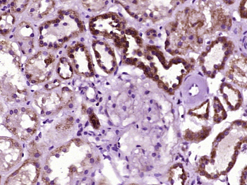 ACACA Rabbit Polyclonal Antibody