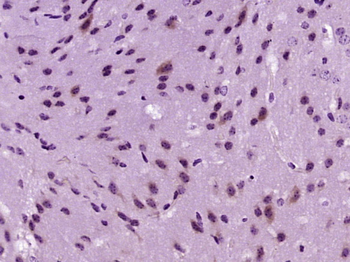 ACACA Rabbit Polyclonal Antibody