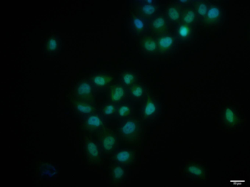 Histone H4 (Acetyl K8) Rabbit Polyclonal Antibody