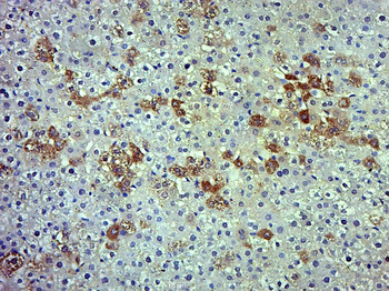 Phospho-ADRB2 (Ser346) Rabbit Polyclonal Antibody