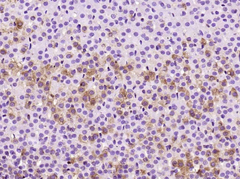 Adenylate cyclase 1 Rabbit Polyclonal Antibody