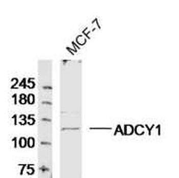 Adenylate cyclase 1 Rabbit Polyclonal Antibody