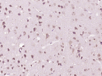 Afadin Rabbit Polyclonal Antibody