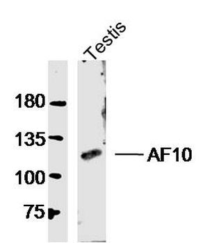 AF10 Rabbit Polyclonal Antibody