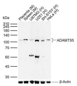 ADAMTS5 Rabbit Polyclonal Antibody