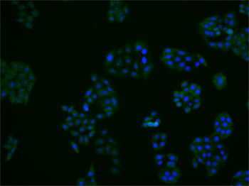 ADK Rabbit Polyclonal Antibody