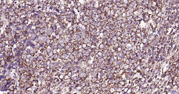 Phospho-ALK (Tyr1604) Rabbit Polyclonal Antibody