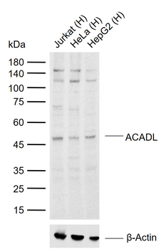 ACADL Rabbit Polyclonal Antibody