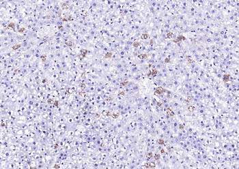 ACADVL Rabbit Polyclonal Antibody