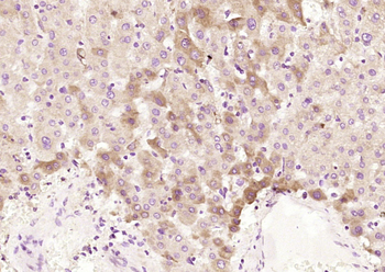 ACADM Rabbit Polyclonal Antibody