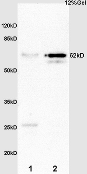 AMPK alpha 2 Rabbit Polyclonal Antibody