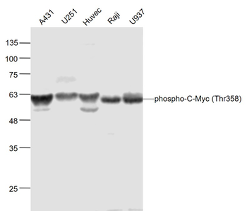 Phospho-C-Myc (Thr358) Rabbit Polyclonal Antibody