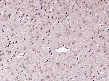 Phospho-AMPK alpha-1 (Ser496+Ser502) Rabbit Polyclonal Antibody