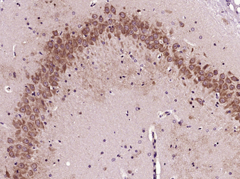 Phospho-AMPK alpha-1 (Ser496+Ser502) Rabbit Polyclonal Antibody