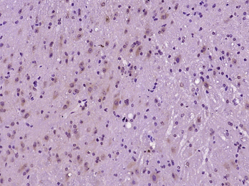 Phospho-AMPK beta 1 (Ser108) Rabbit Polyclonal Antibody