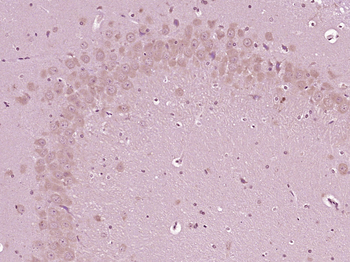 Phospho-AMPK beta 1 (Ser108) Rabbit Polyclonal Antibody