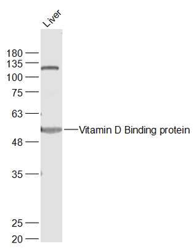Vitamin D Binding protein Rabbit Polyclonal Antibody