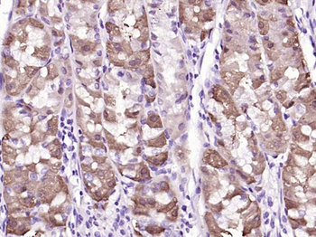 ATG5/APG5L Rabbit Polyclonal Antibody