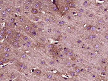 ATG5/APG5L Rabbit Polyclonal Antibody