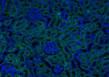 ATG5/APG5L Rabbit Polyclonal Antibody