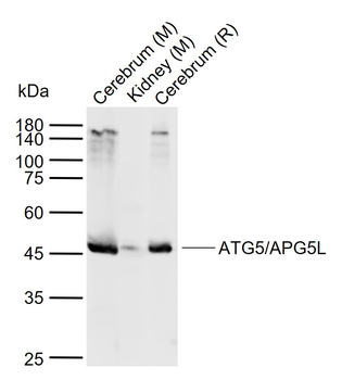 ATG5/APG5L Rabbit Polyclonal Antibody