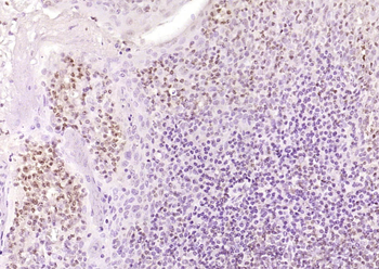 OGG1 Rabbit Polyclonal Antibody