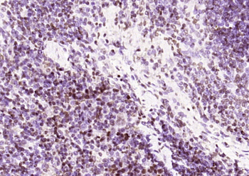 OGG1 Rabbit Polyclonal Antibody