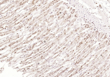 OGG1 Rabbit Polyclonal Antibody
