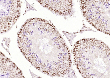 OGG1 Rabbit Polyclonal Antibody