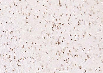 OGG1 Rabbit Polyclonal Antibody