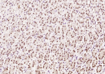 OGG1 Rabbit Polyclonal Antibody