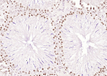 OGG1 Rabbit Polyclonal Antibody