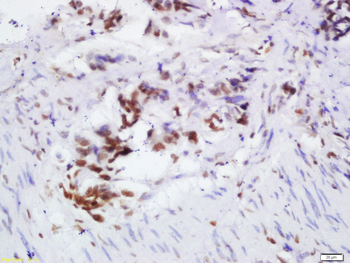 OGG1 Rabbit Polyclonal Antibody