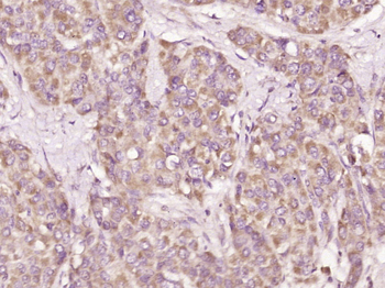 APOA2 Rabbit Polyclonal Antibody