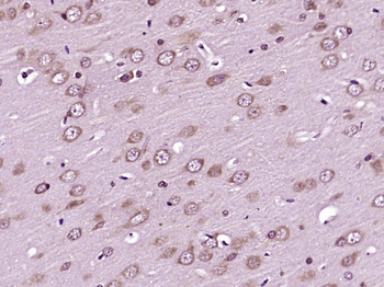 AANAT Rabbit Polyclonal Antibody